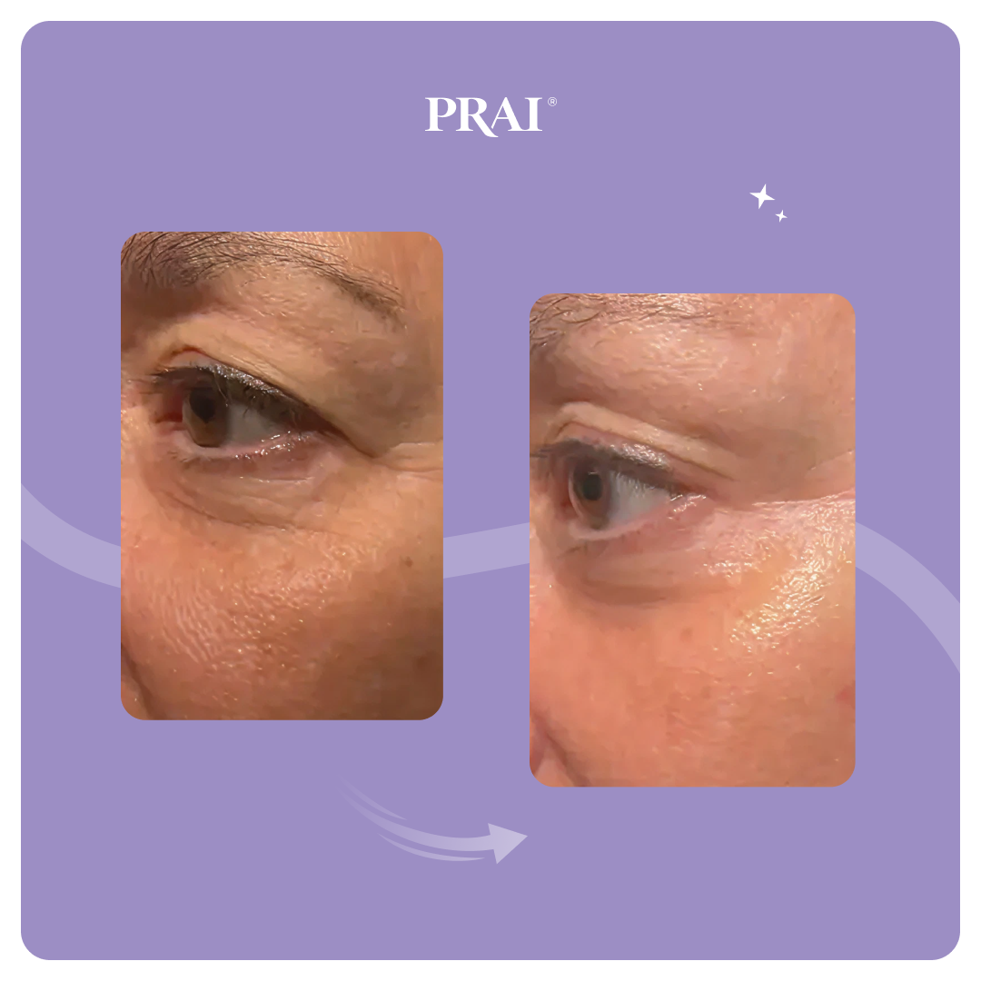 Ageless Eye Tight Uplift Serum